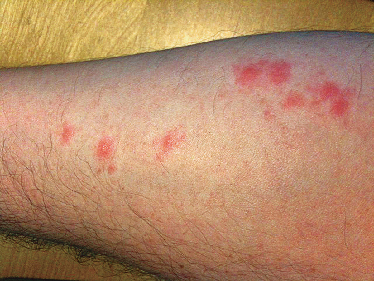 Don t Let The Bed Bugs Bite Braman Termite Pest Elimination
