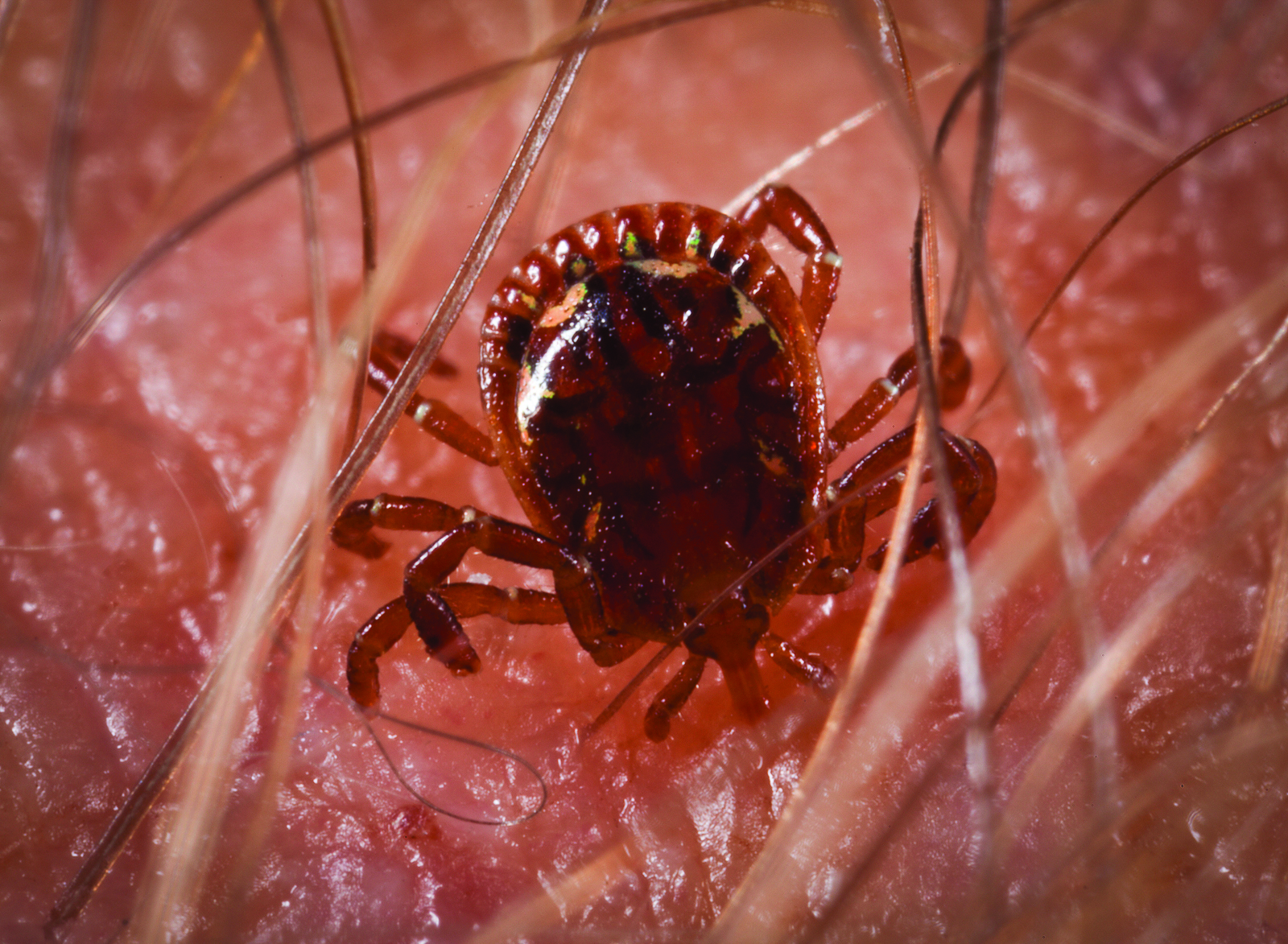 tick